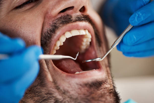Best Knocked-Out Tooth Emergency  in Wilmerding, PA